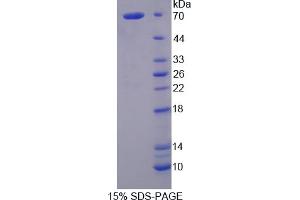 Image no. 1 for Fibrinogen alpha Chain (FGA) (AA 39-615) protein (His tag) (ABIN4988611) (FGA Protein (AA 39-615) (His tag))