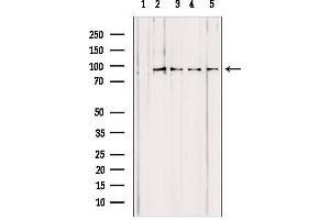 Western blot analysis of extracts from various samples, using PYGL antibody. (PYGL antibody  (Internal Region))