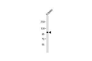 Anti-ANKRD6 Antibody (Center) at 1:1000 dilution + human brain lysate Lysates/proteins at 20 μg per lane. (ANKRD6 antibody  (AA 314-343))