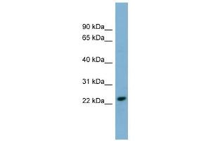 KLRC3 antibody used at 1 ug/ml to detect target protein. (KLRC3 antibody  (N-Term))