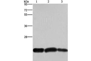Western Blot analysis of A375 and Raji cell, Human fetal brain tissue using CBX3 Polyclonal Antibody at dilution of 1:600 (CBX3 antibody)