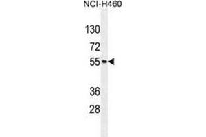 Western blot analysis in NCI-H460 cell line lysates (35ug/lane) using MIER2 Antibody (N-term). (MIER2 antibody  (N-Term))