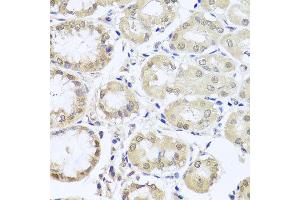 Immunohistochemistry of paraffin-embedded human stomach using CGB7 antibody at dilution of 1:100 (x40 lens). (CGB7 antibody)