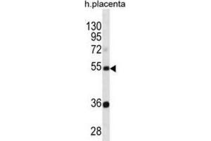 Western Blotting (WB) image for anti-Tektin 3 (TEKT3) antibody (ABIN3000961)
