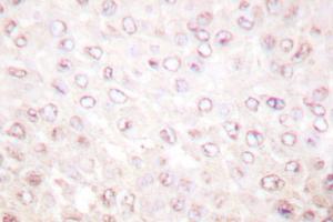 Image no. 1 for anti-K(lysine) Acetyltransferase 2B (KAT2B) antibody (ABIN271904) (KAT2B antibody)