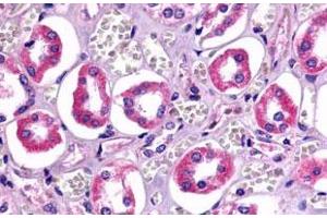 Immunohistochemistry (Formalin/PFA-fixed paraffin-embedded sections) of human kidney, renal tubules with TAAR6 polyclonal antibody . (TAAR6 antibody  (Cytoplasmic Domain))