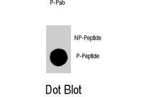 Dot blot analysis of CDKN1B (phospho T198) polyclonal antibody  on nitrocellulose membrane.