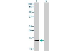 Western Blotting (WB) image for anti-Replication Protein A3, 14kDa (RPA3) (AA 12-121) antibody (ABIN562685)