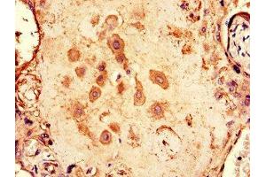 Immunohistochemistry of paraffin-embedded human placenta tissue using ABIN7146624 at dilution of 1:100 (ARPP19 antibody  (AA 2-105))