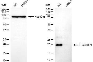 Western blotting analysis using ITGB1BP1 antibody (ABIN7799068).