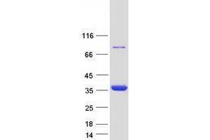 Validation with Western Blot (TPM3 Protein (Transcript Variant 5) (Myc-DYKDDDDK Tag))