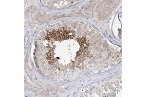 Immunohistochemical staining of human testis with ADAMTS12 polyclonal antibody  shows strong cytoplasmic positivity in subsets of seminiferus duct cells at 1:50-1:200 dilution. (ADAMTS12 antibody)