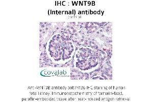 Image no. 1 for anti-Wingless-Type MMTV Integration Site Family, Member 9B (WNT9B) (Internal Region) antibody (ABIN1740845) (WNT9B antibody  (Internal Region))