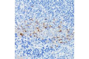 Immunohistochemistry of paraffin-embedded mouse spleen using CD225/IFITM1 antibody (ABIN1680390, ABIN3018715, ABIN3018716 and ABIN6220553) at dilution of 1:100 (40x lens). (IFITM1 antibody  (C-Term))