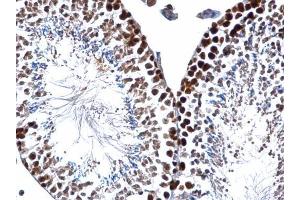 IHC-P Image PCNA antibody detects PCNA protein at nucleus on mouse testis by immunohistochemical analysis. (PCNA antibody)