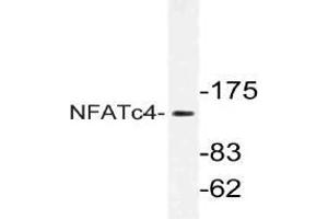 Western blot analysis of NFATc4 Antibody NFATc4 in extracts from Jurkat cells. (NFATC4 antibody)