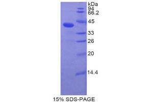 SDS-PAGE (SDS) image for Bone Morphogenetic Protein 10 (BMP10) (AA 315-424) protein (His tag,GST tag) (ABIN1877375)