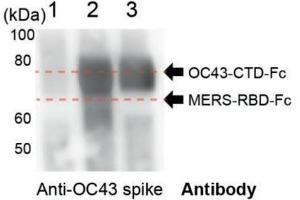 Purified protein identities were further confirmed by Western blot analysis using an anti‐OC43 spike antibody. (hCoV-OC43 Spike antibody  (AA 15-344))
