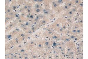 Immunohistochemistry (IHC) image for anti-alpha-2-Glycoprotein 1, Zinc-Binding (AZGP1) (AA 180-298) antibody (ABIN7430039)
