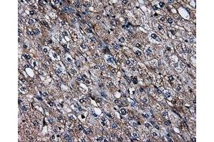 Immunohistochemical staining of paraffin-embedded liver tissue using anti-SATB1mouse monoclonal antibody. (SATB1 antibody)