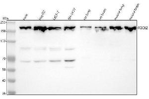 Western blot analysis of ROCK2 using anti-ROCK2 antibody (ABIN7606201).
