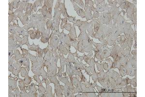 Immunoperoxidase of monoclonal antibody to SGCB on formalin-fixed paraffin-embedded human heart. (SGCB antibody  (AA 87-196))