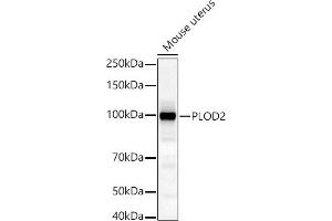 Western blot analysis of extracts of Mouse uterus, using PLOD2/LH2 antibody (ABIN6132888, ABIN6145788, ABIN6145790 and ABIN6222693) at 1:1000 dilution. (PLOD2 antibody  (AA 470-650))