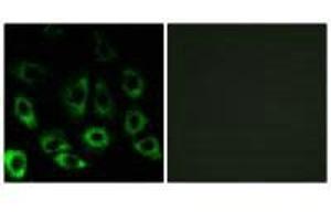 Immunofluorescence analysis of A549 cells, using MBTPS2 antibody. (MBTPS2 antibody)