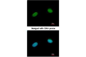 Immunofluorescence staining of Paraformaldehyde-Fixed HeLa using of AP23777PU-N XRCC3 antibody at 1/200 dilution. (XRCC3 antibody  (AA 202-296))