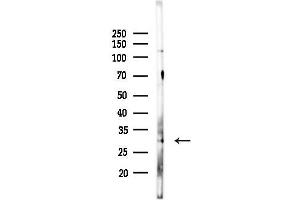 Western blot analysis of lysates from F10-LUC cells(heat-shock,45 min treatment), using HLA-DR Antibody at 1/1000 dilution.