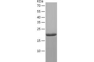 CHMP6 Protein (AA 1-201) (His tag)