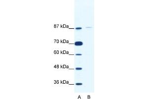 WB Suggested Anti-TAF1C Antibody Titration:  2. (TAF1C antibody  (C-Term))