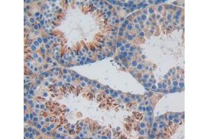 IHC-P analysis of Kidney tissue, with DAB staining. (RIPK2 antibody  (AA 1-294))