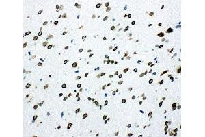 IHC-F testing of SHC antibody and rat brain tissue (SHC1 antibody  (C-Term))