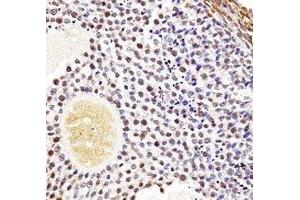 Wee2 antibody immunohistochemistry analysis in formalin fixed and paraffin embedded mouse ovarian tissue. (WEE2 antibody  (AA 364-393))