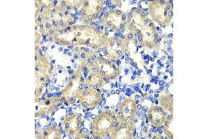 Immunohistochemistry of paraffin-embedded rat kidney using ABAT antibody (ABIN1876487) at dilution of 1:100 (40x lens). (ABAT antibody)