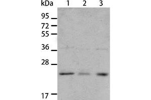 Western Blot analysis of A431 and A172 cell, Human liver cancer tissue using BNIP1 Polyclonal Antibody at dilution of 1:550 (BNIP1 antibody)