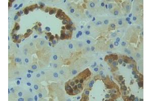 DAB staining on IHC-P; Samples: Human Kidney Tissue (RYK antibody  (AA 308-570))