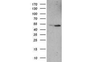 HEK293T cells were transfected with the pCMV6-ENTRY control (Left lane) or pCMV6-ENTRY ETF1 (Right lane) cDNA for 48 hrs and lysed. (ETF1 antibody)