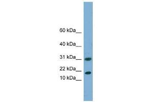 EIF5A2 antibody used at 1 ug/ml to detect target protein. (EIF5A2 antibody  (N-Term))