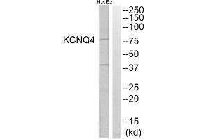 Western blot analysis of extracts from HuvEc cells, using KCNQ4 antibody. (KCNQ4 antibody  (C-Term))