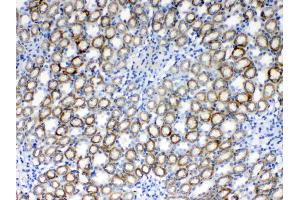 IHC analysis of RPS6 using anti- RPS6 antibody . (RPS6 antibody  (N-Term))