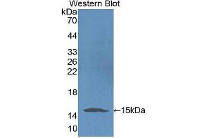 Western Blotting (WB) image for anti-Serpin Peptidase Inhibitor, Clade G (C1 Inhibitor), Member 1 (SERPING1) antibody (Biotin) (ABIN1172652) (SERPING1 antibody  (Biotin))