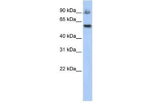 ASCC2 antibody used at 1 ug/ml to detect target protein.