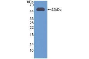 Detection of Recombinant OXCT1, Human using Polyclonal Antibody to 3-Oxoacid Coenzyme A Transferase 1 (OXCT1) (OXCT1 antibody  (AA 40-489))