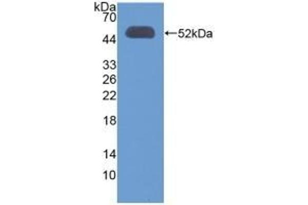 OXCT1 抗体  (AA 40-489)