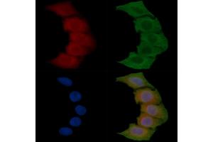ABIN6257413 and ABIN6275351 staining Hela cells(45 min of heat-shock) by IF/ICC. (PEX7 antibody  (C-Term))
