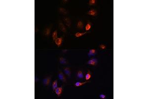 Immunofluorescence analysis of U-251MG cells using B antibody (ABIN6129977, ABIN6137413, ABIN6137415 and ABIN6220894) at dilution of 1:100. (BACE1 antibody  (AA 22-322))