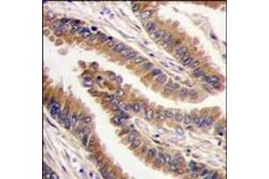 Image no. 2 for anti-Protein Kinase, X-Linked (PRKX) (C-Term) antibody (ABIN360336) (PRKX antibody  (C-Term))