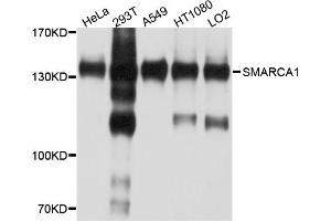 Western blot analysis of extracts of various cell lines, using SMARCA1 antibody.